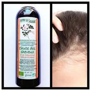 Chute des cheveux (synergie d'hydrolats)